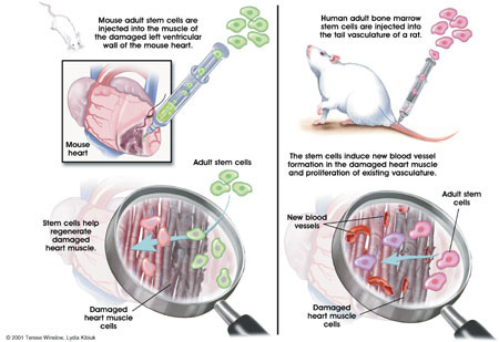 Graphic depicting heart muscle repair with adult stem cells