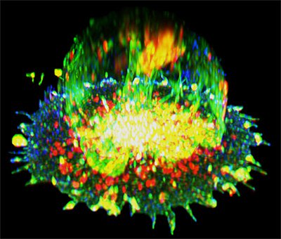 Immunofluorescence imaging captures an auto-signaling T cell. credit NIAID