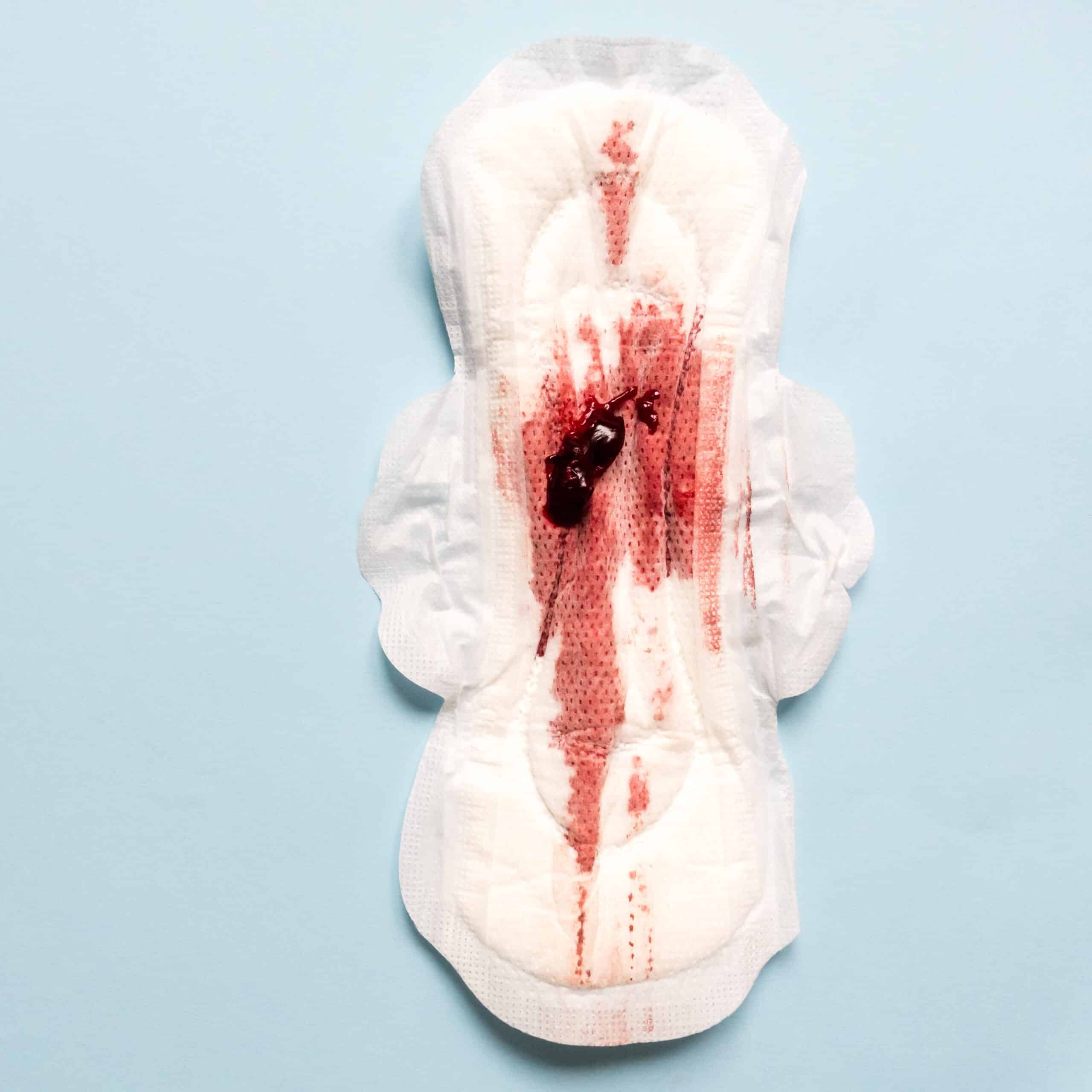 menstrual blood, menses, period blood, normal period