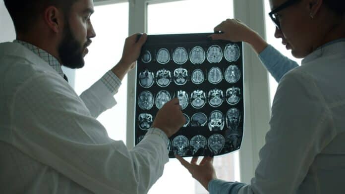brain injury, X-ray, brain stem injury, brain stem,